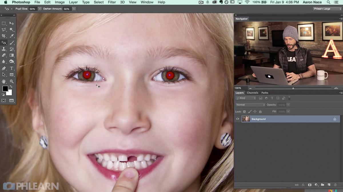 steps to remove red eye